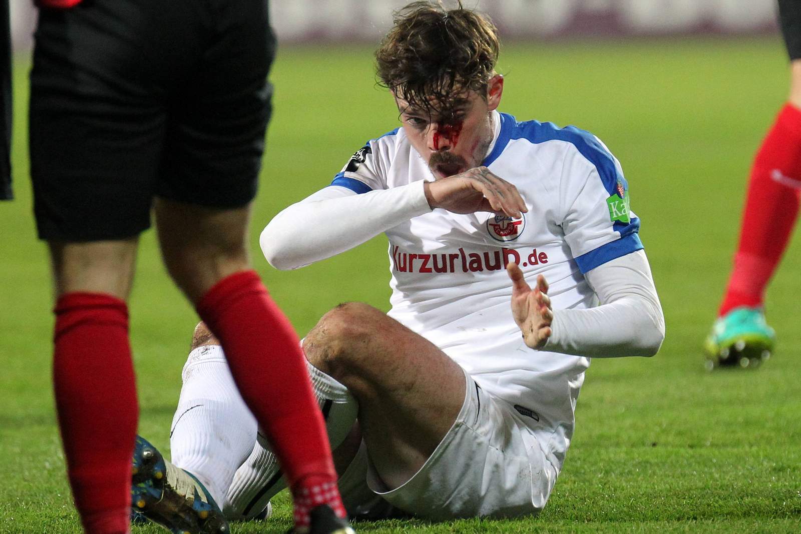 erdmann rostock 3.liga Dennis Erdmann von Hansa Rostock mit Nasenbeinbruch